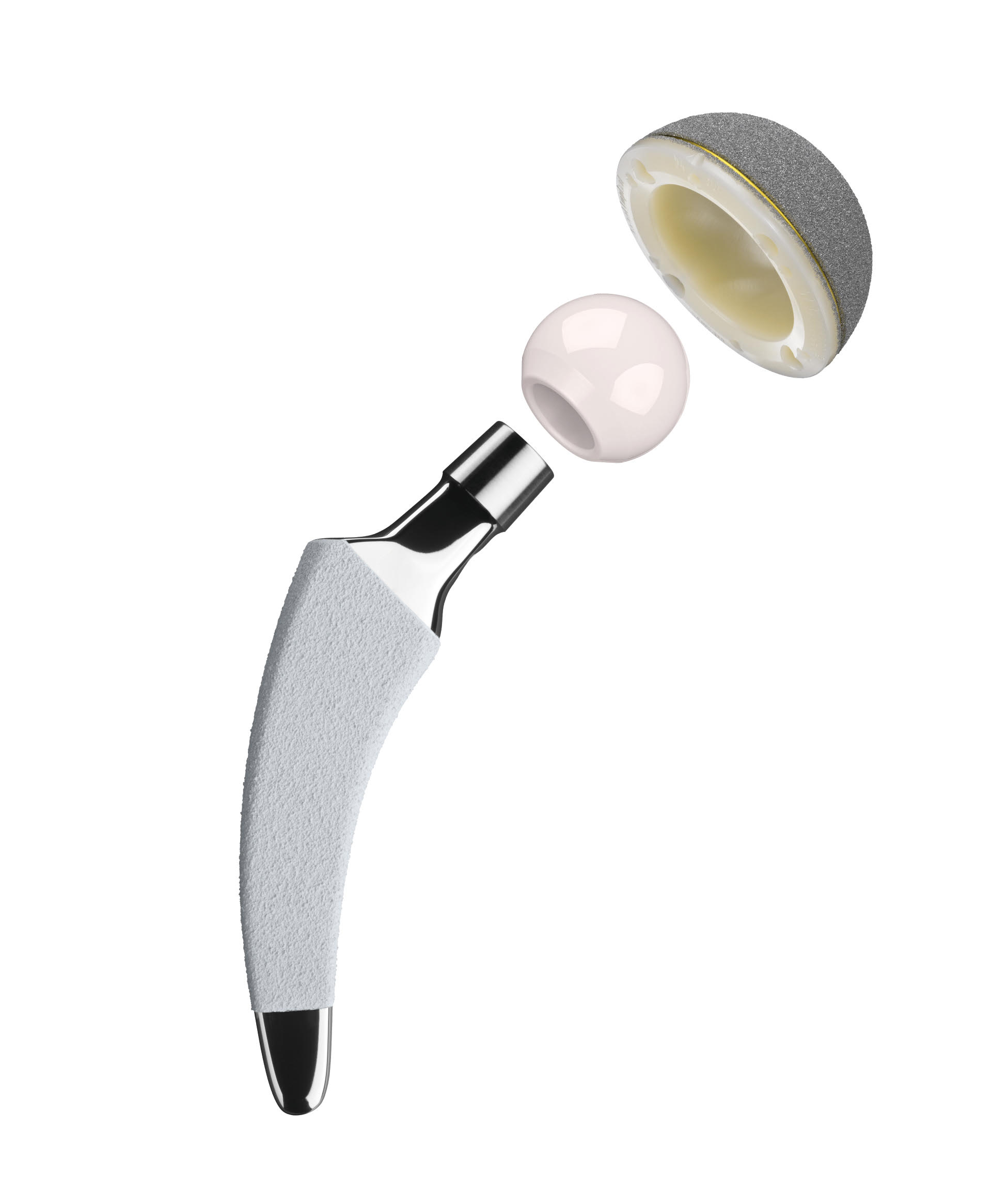 Chirurgie prothétique hanche